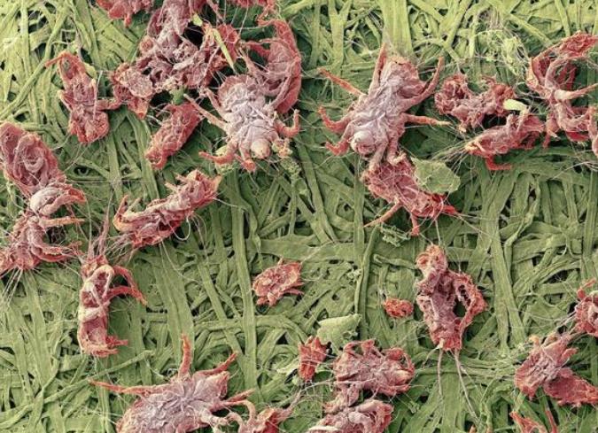 十年床垫有螨虫吗,床垫螨虫最好用什么药