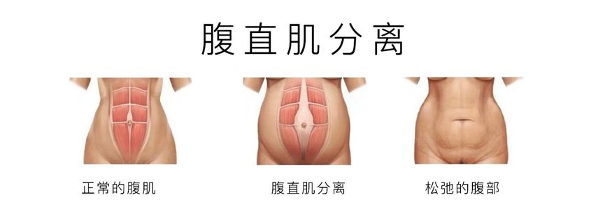 全智贤生完二胎,纤瘦似少女,小s与三个女儿合照像姐妹——产后恢复的好不好,决定了你是加速衰老还是逆生长!