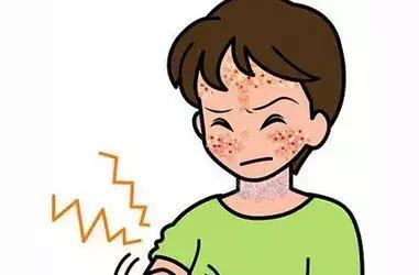 一晒太阳脸就过敏发红起皮,一晒太阳就过敏起疹子