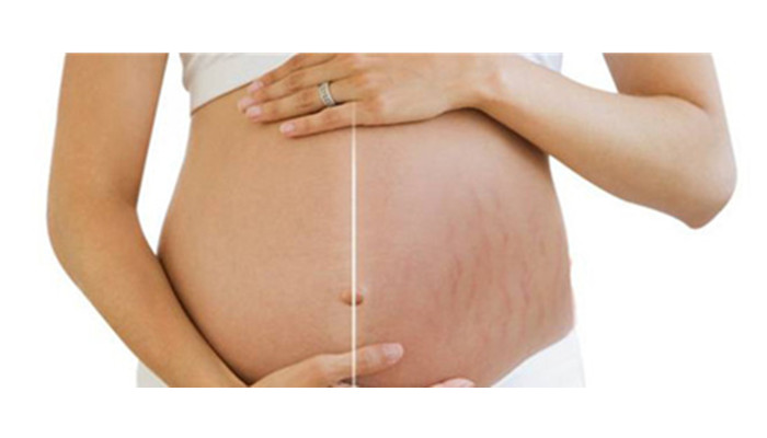 孕妇产后适合吃燕窝吗,孕妈各个阶段吃燕窝的好处