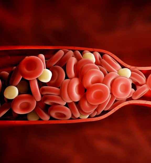 静脉曲张详细解说,静脉曲张知识大全书籍