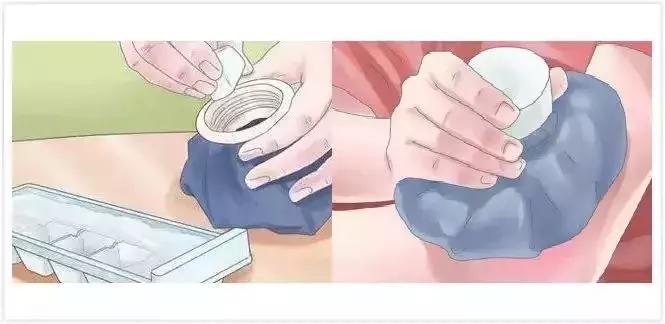 为什么你的身上会无缘无故出现淤青？这4种情况最要命