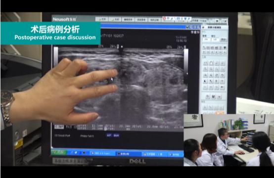 微波消融术，让甲状腺患者康复“加速度”