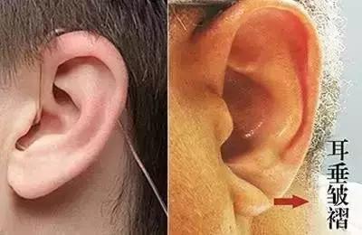 网红疤痕膏靠谱吗,网红祛疤产品真的有效吗