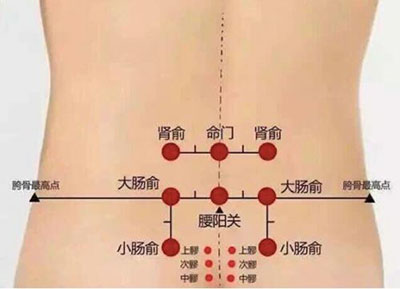 中医拔罐需要注意什么,中医拔罐的正确操作步骤