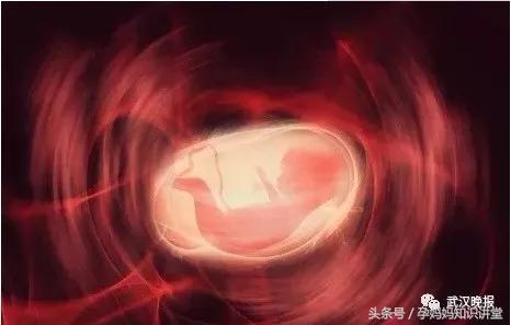 怀了双胞胎只生了一个怎么回事,怀孕双胞胎只生一个真相是什么