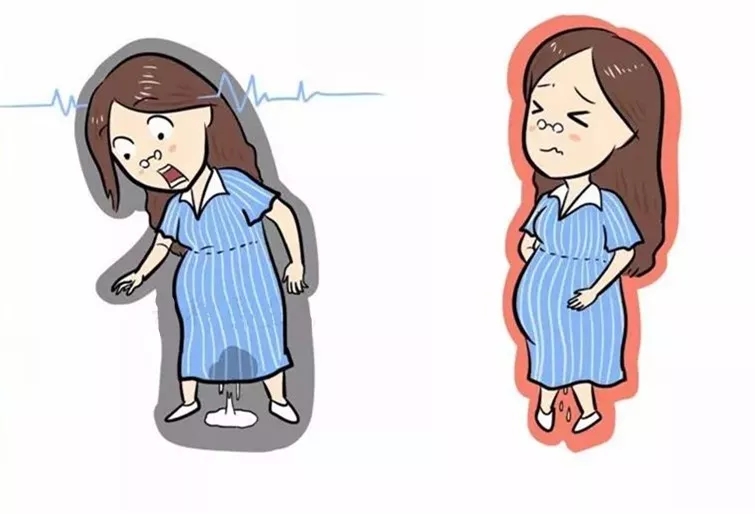 孕妇破水和漏尿有什么不一样的,破水和漏尿怎么辨别啊