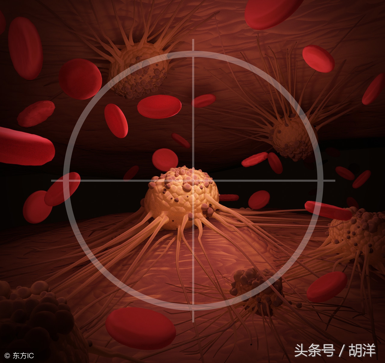 肺癌转移还能活多久，我的一些病人已活过9年，他们是怎么做到的