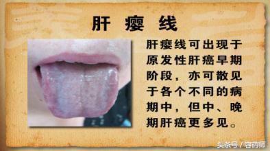 调理脾胃保肝的药,脾胃不好情绪会不会很差