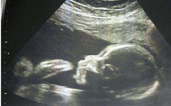 最常见的人工流产方式，这些危害你都知道吗，一个比一个残忍