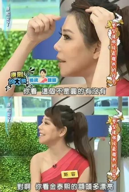 花百万整形60多次被嘲青蛙脸，这个台湾女主持真豁得出去