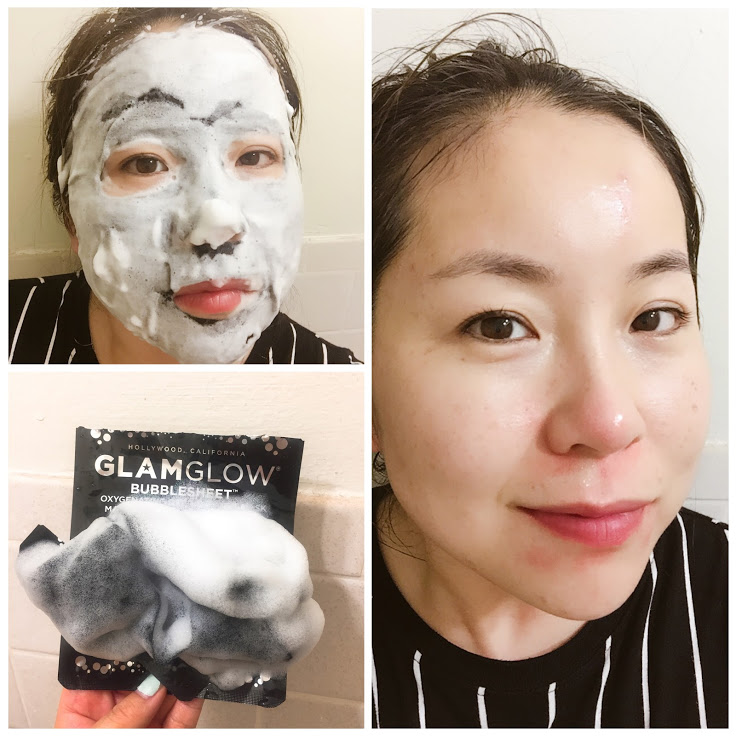 百万的八月爱用品:我成功消灭荷尔蒙痘痘了,成人痘保养经验分享