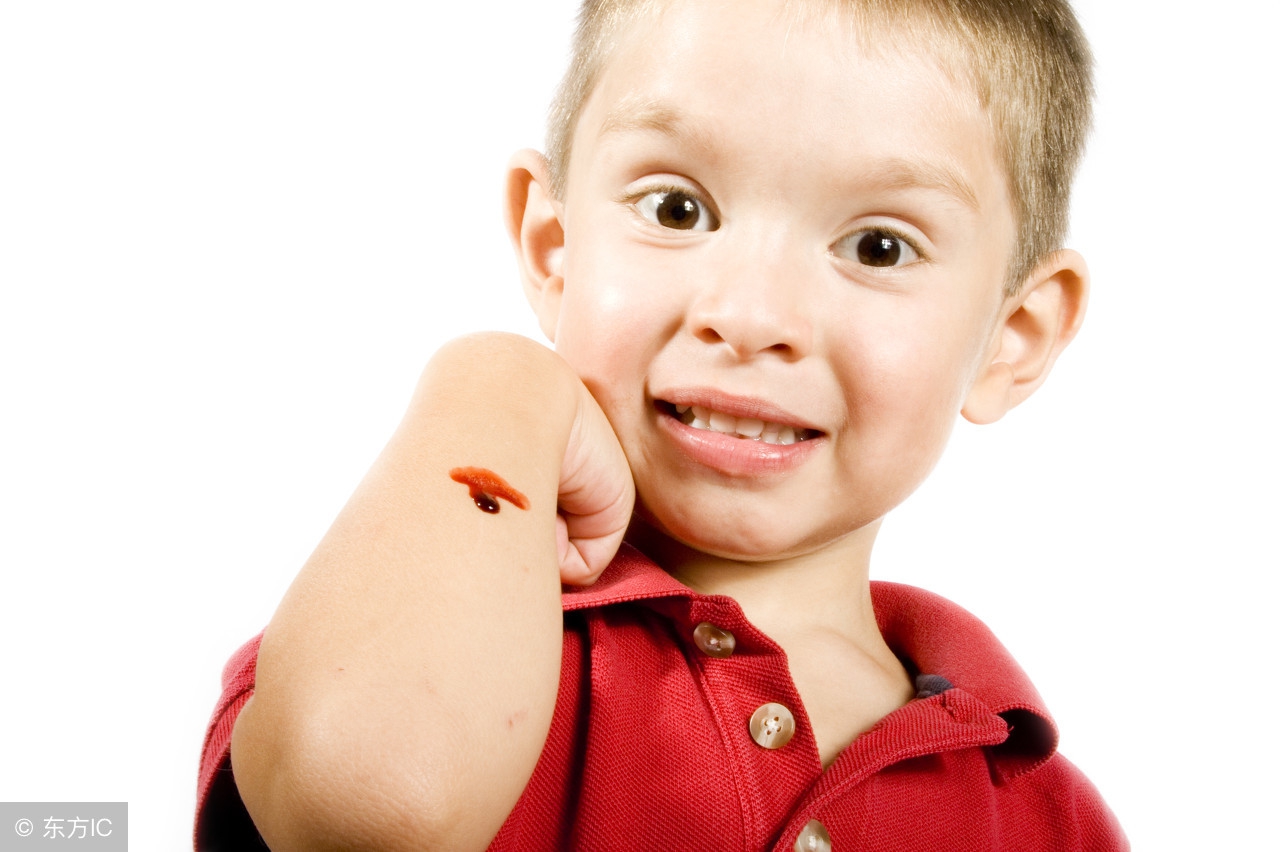 小孩膝盖擦伤可以用双氧水吗,孩子磕伤碘伏消毒用多久