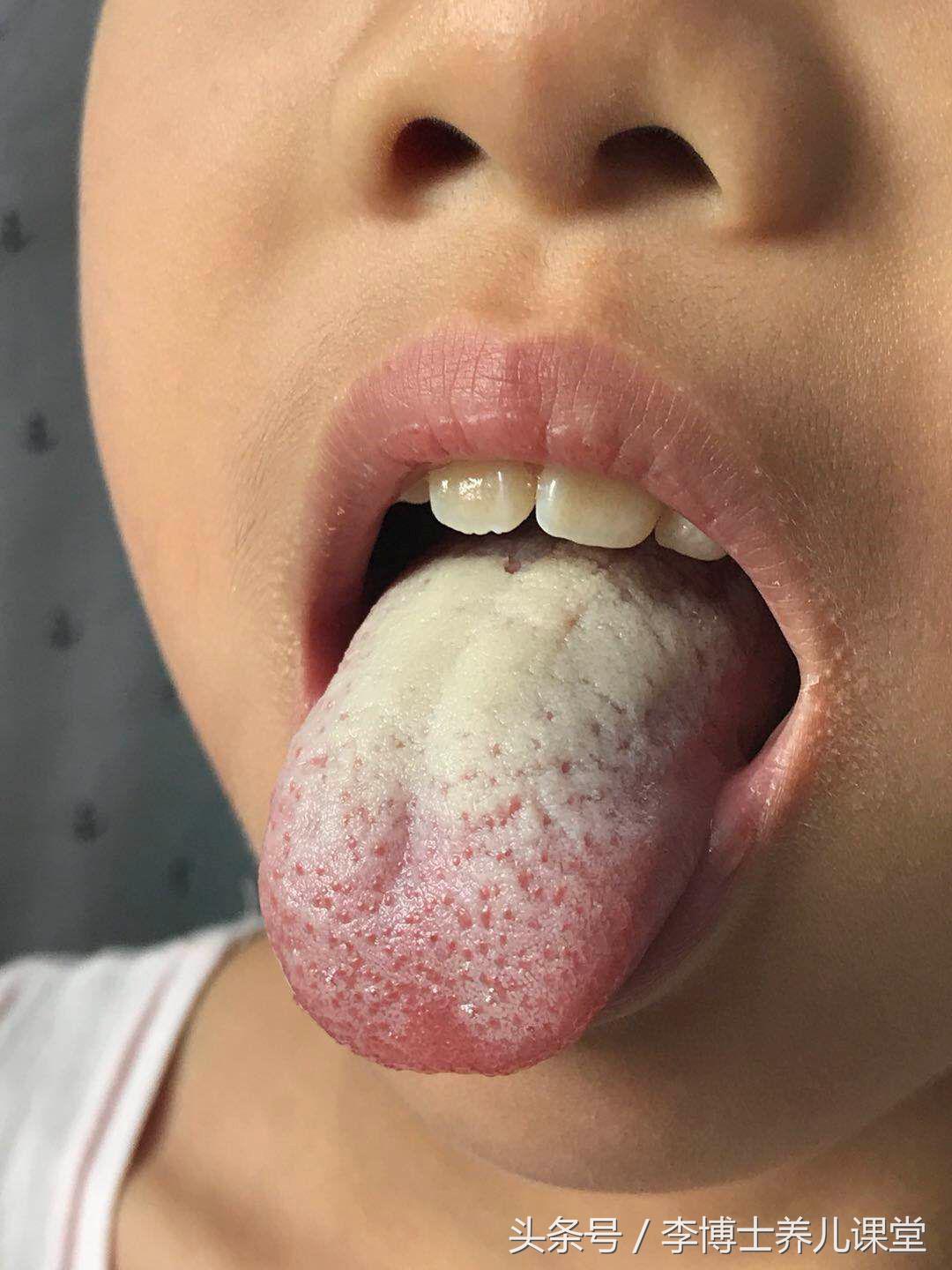 肾虚气虚湿气重的调理步骤,肾虚湿气重吃什么补最快最好