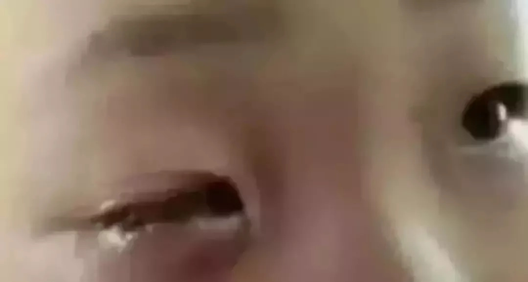 孩子眼球被融化的东西很常见,孩子眼球被融化新闻