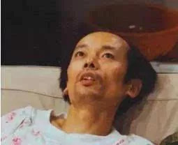 游泳腋下磨出茧,游泳磨腋下