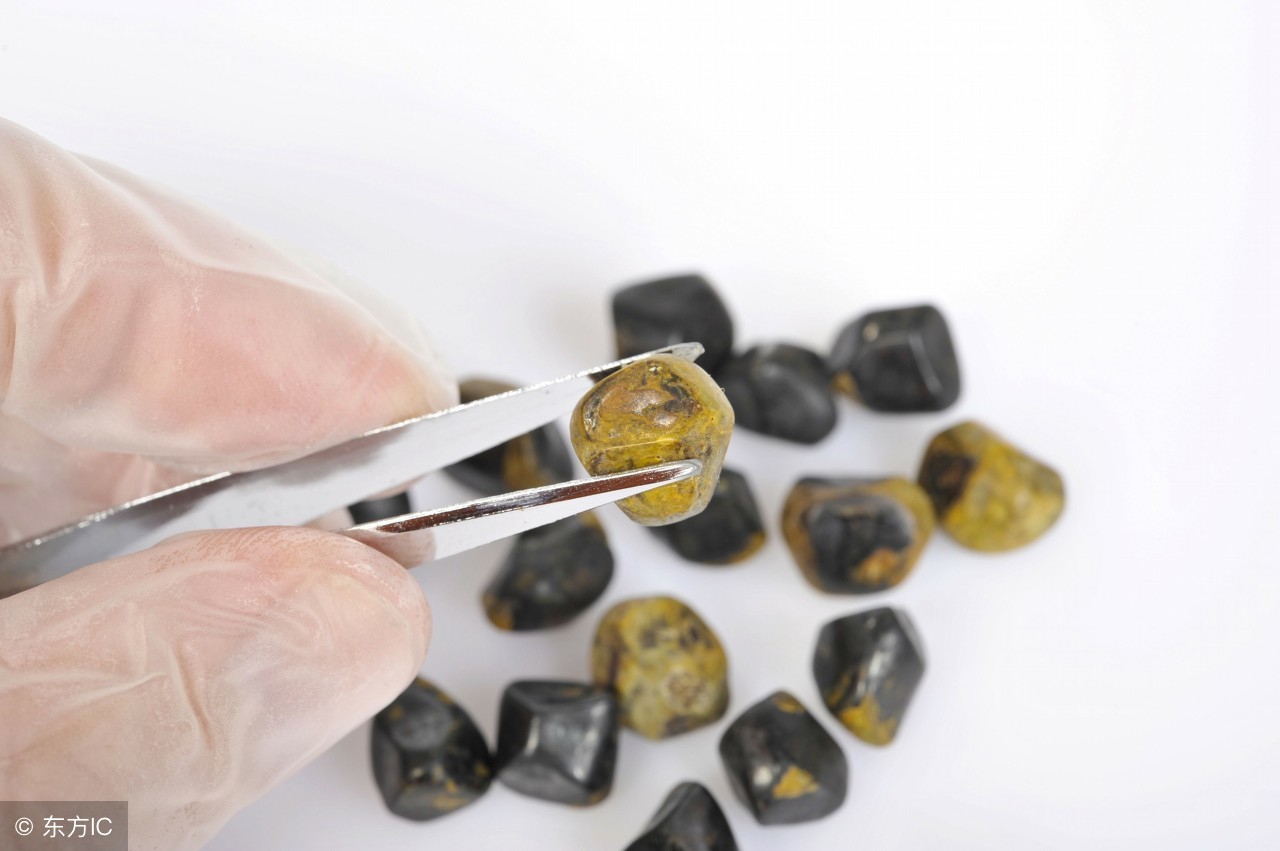 治疗胆结石最好的偏方,治疗胆结石有效偏方