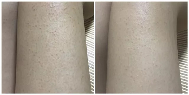 小林制药必买清单夏天,小林制药有哪些好东西推荐