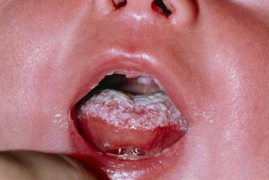 专治孩子积食特别小的丸,三岁宝宝山楂鸡内金万能积食方