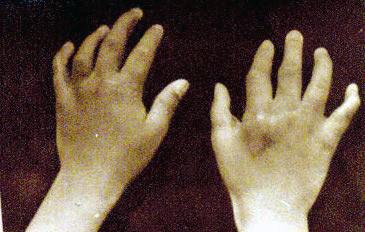 手外科和手内科的区别,手外科都包括什么病症