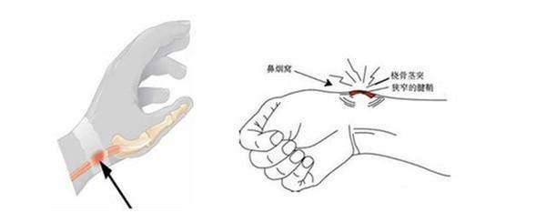 手外科和手内科的区别,手外科都包括什么病症