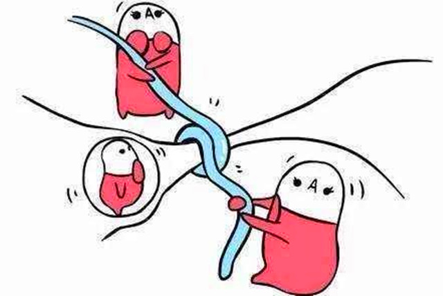 男人结扎术避孕效果,男人结扎避孕效果