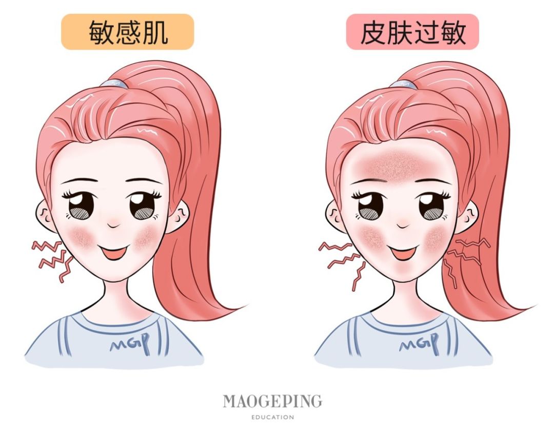 拯救敏感肌肤的方法,拯救敏感肌淡化细纹