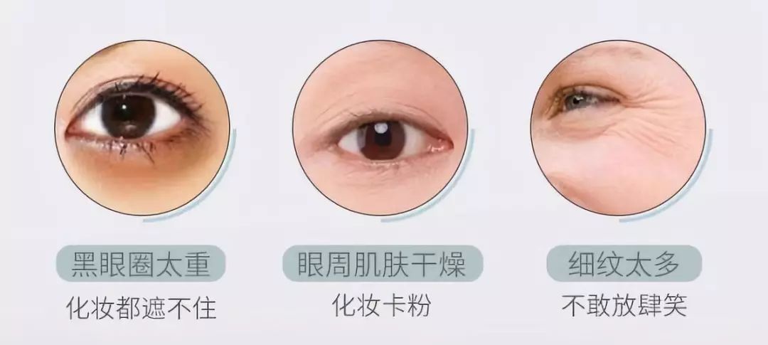 最有效平价去皱纹黑眼圈眼霜,怎样用眼霜效果好