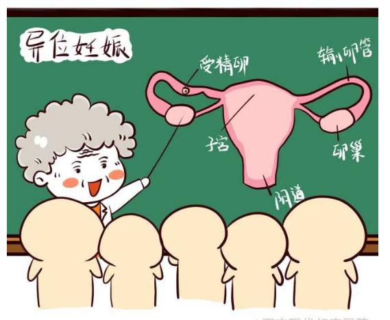 宫外孕有多可怕,宫外孕最危险会出现什么情况