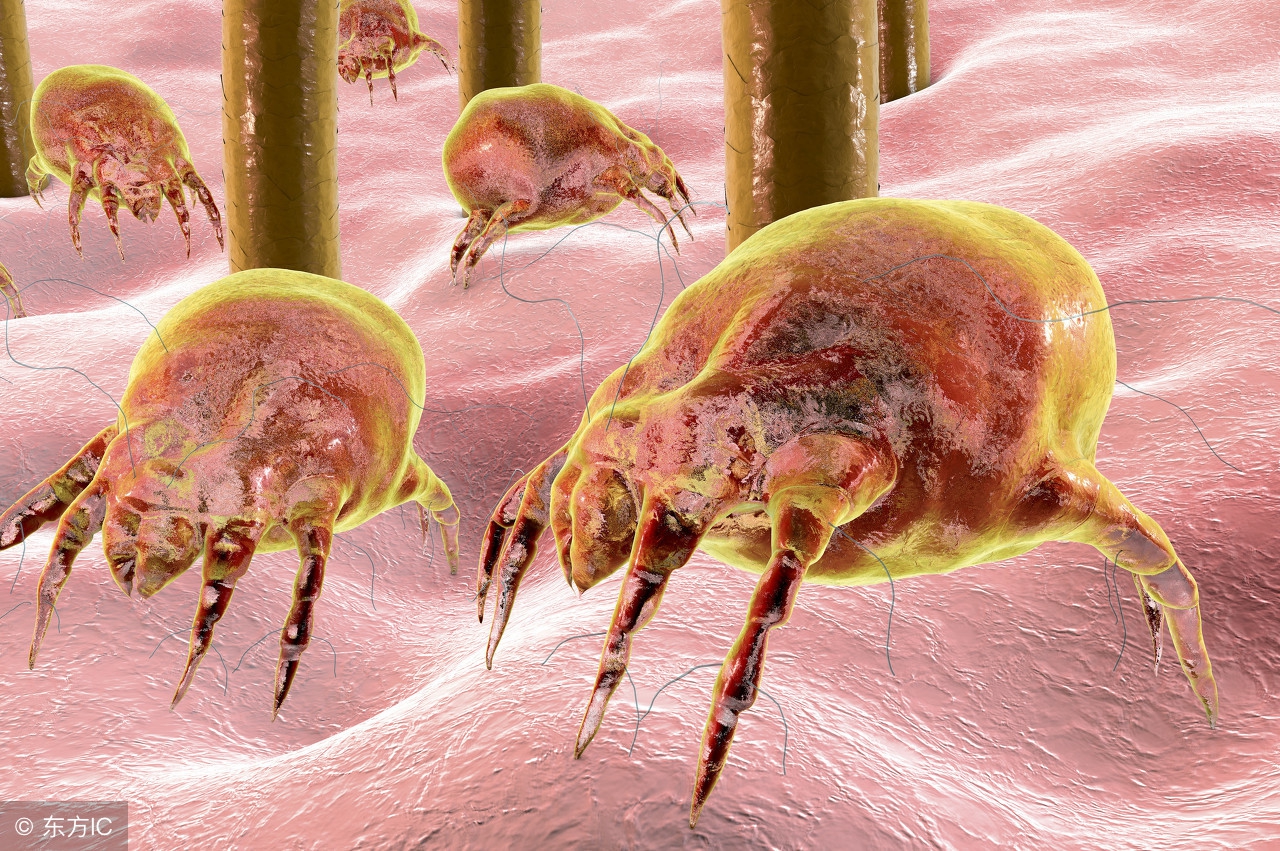 后背螨虫的症状和治疗方法,螨虫爬过皮肤的症状