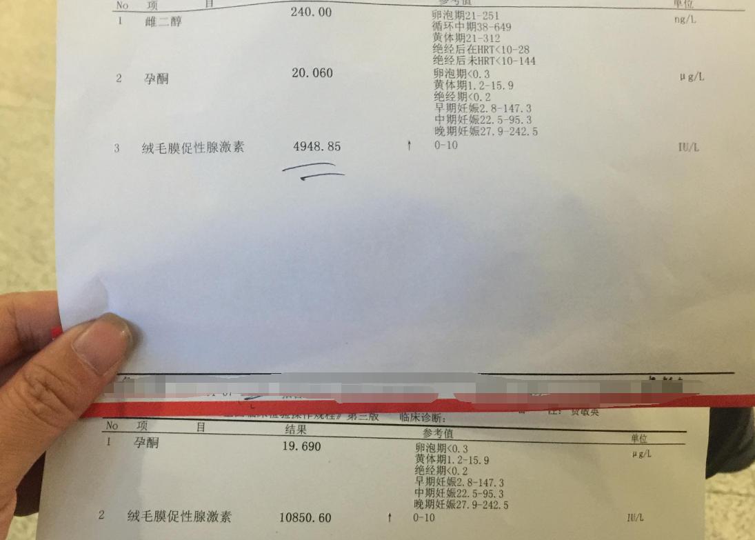验孕棒怎么测早孕最准,验早孕的方法有几种