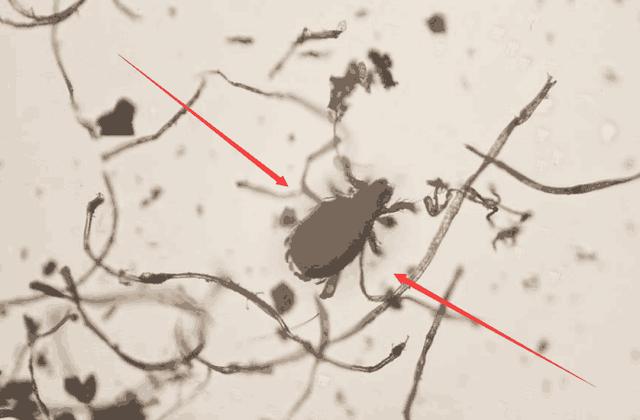 家庭养螨虫最好的方法,家中放一物可以杀灭所有螨虫