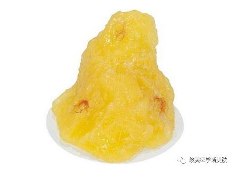 「杏林微科普」带您了解:中医穴位埋线