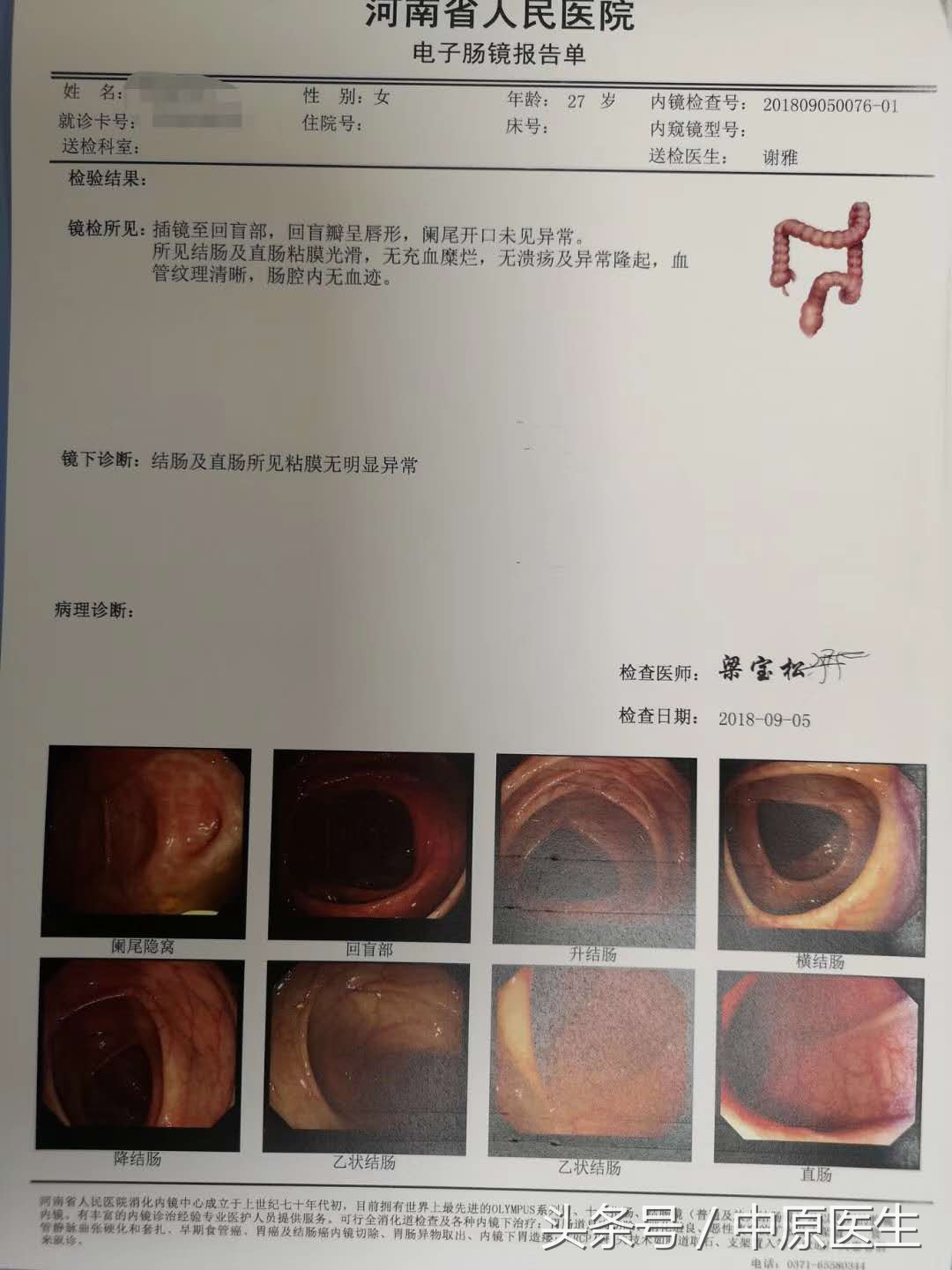 为什么医生不建议年轻人做结肠镜,外国人的小肠和中国人不一样吗