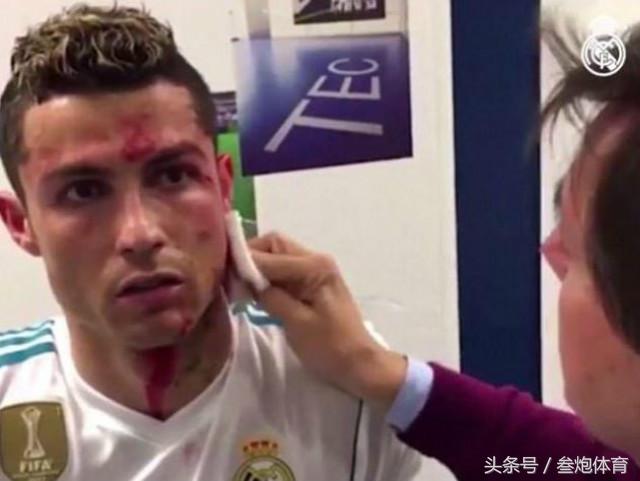 c罗心疼,心疼c罗的文案