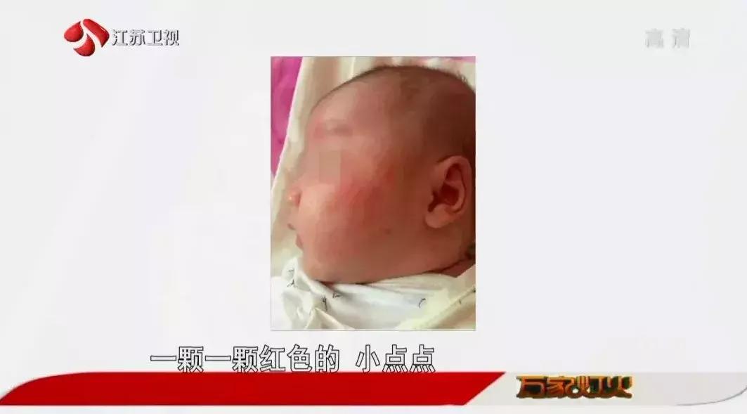 季节过敏性皮肤病怎么办,皮肤科湿疹什么季节容易犯