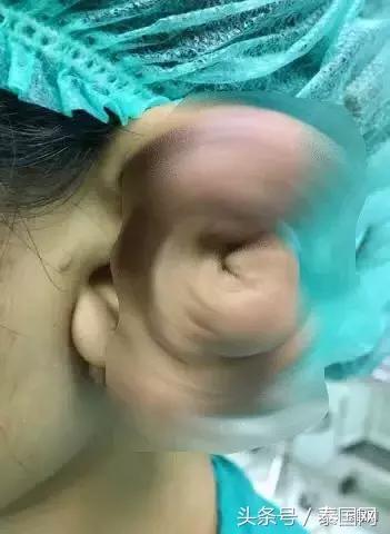 泰国女人打耳洞视频,泰国女子打耳洞