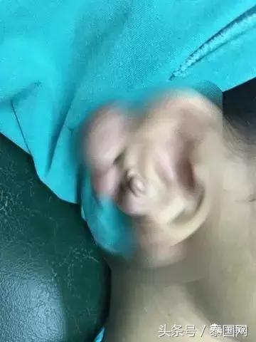 泰国女人打耳洞视频,泰国女子打耳洞