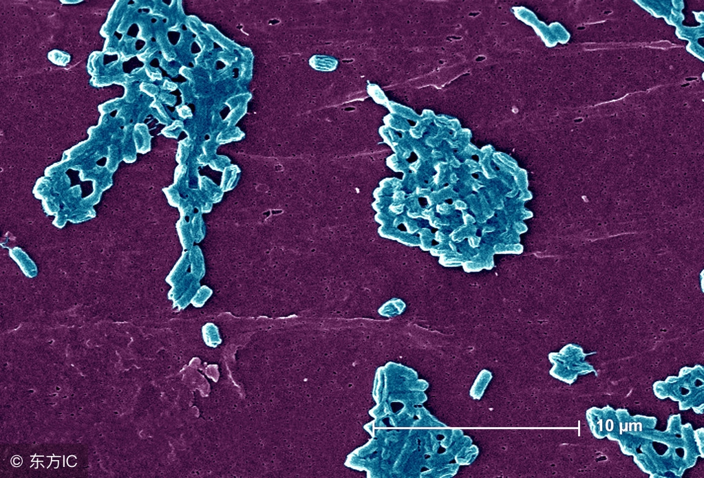 败血症的预防办法都有哪些呢？败血症要如何饮食