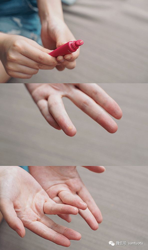 第一次去别的城市水土不服正常嘛,第一次去北方水土不服脸肿