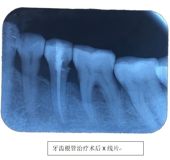 脸部疼痛疾病,脸部疼痛可能是什么病