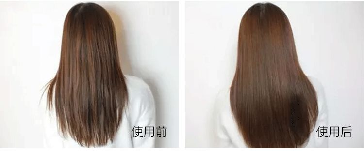 网红都在穿的矫正驼背内衣,能解决驼背的内衣