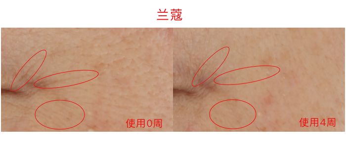 lamer眼霜和sk2,40-50眼霜测评