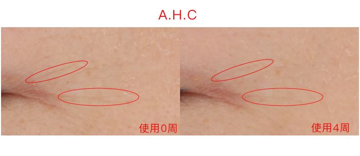 lamer眼霜和sk2,40-50眼霜测评