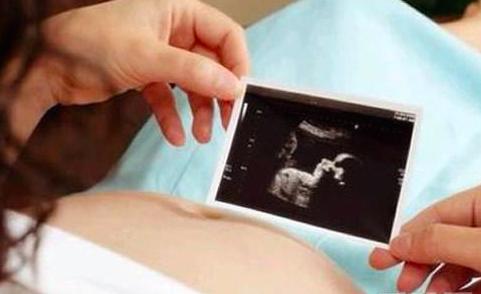 产前超声怎么判断胎儿缺陷,产前诊断可发现胎儿哪些疾病