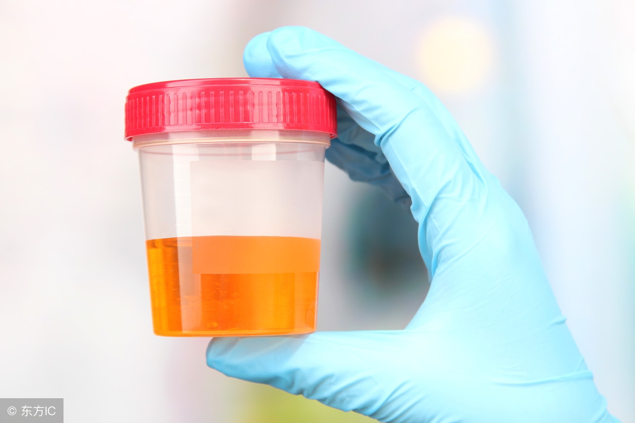 脚踝痛风反复发作吃什么药,脚踝痛风吃什么药好