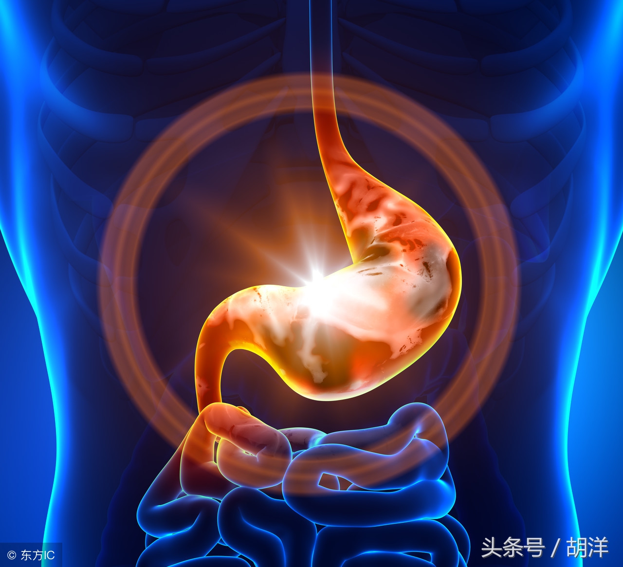 缓解胃肠胀气最快方法,胃肠胀气最好方法