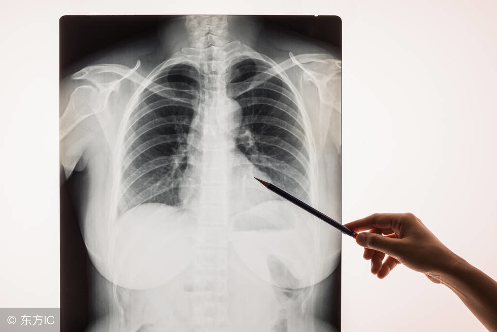 肺炎的症状用药原则,小孩支原体肺炎用药原则