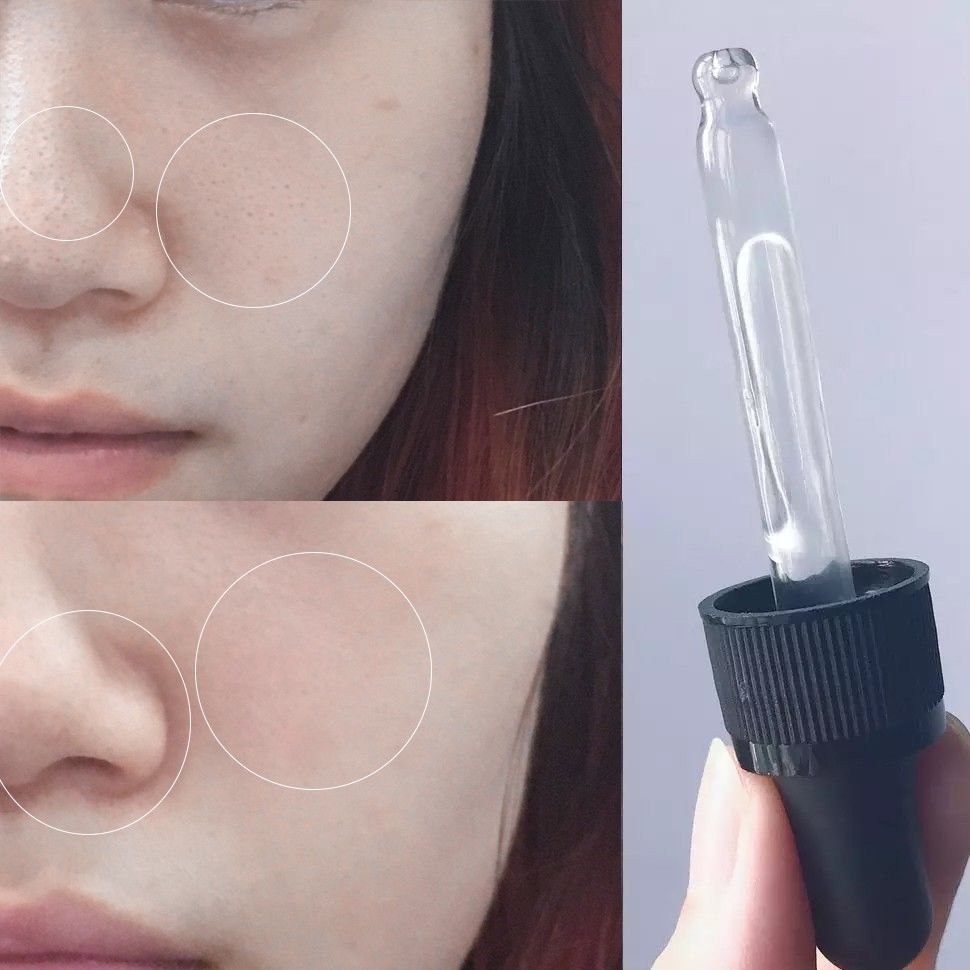 磨皮神器隐形毛孔真实效果,粗毛孔去黑头测评