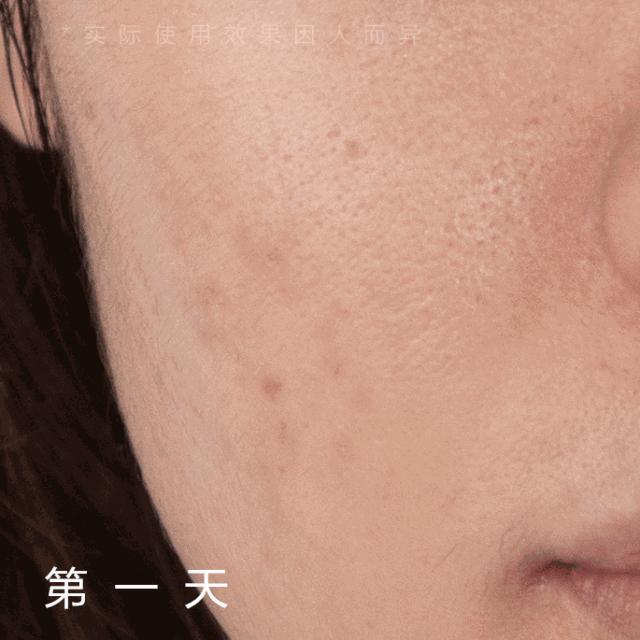 磨皮神器隐形毛孔真实效果,粗毛孔去黑头测评